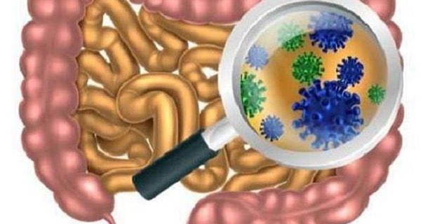 شیرین کننده های مصنوعی موجب تغییر میکروبیوم روده می شوند