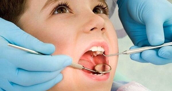 آمار بالای دندان‌های خراب ایرانی‌ها/ کشیدن دندان؛ تنها گزینه مردم