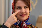 رفع گودی زیر چشم در مشهد: تزریق ژل بهتر است یا چربی؟ | کلینیک شاپرک