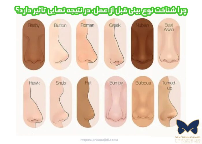 چرا شناخت نوع بینی قبل از عمل، در نتیجه نهایی تاثیر دارد؟